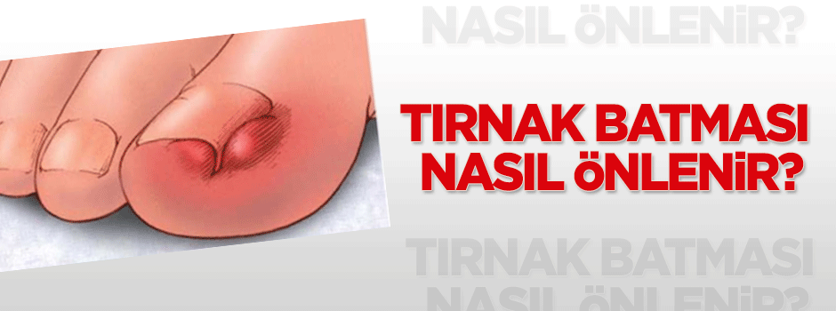 Tırnak batması nasıl önlenir?