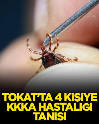 Tokat’ta 4 kişiye KKKA hastalığı tanısı