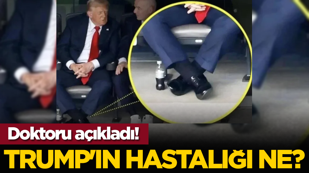 Trump'ın hastalığı ne? Doktoru açıkladı!