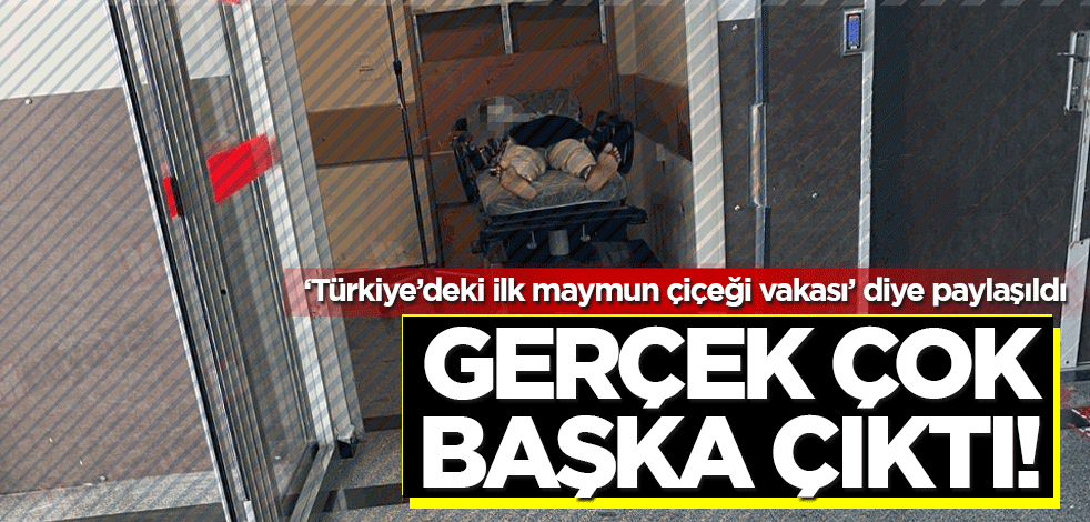 "Türkiye'deki ilk maymun çiçeği vakası" diye paylaşıldı, gerçek ortaya çıktı
