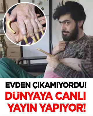 Türkiye'nin konuştuğu Barış mutasyon geçirdi! Evden çıkamıyordu, dünyaya canlı yayın yapıyor