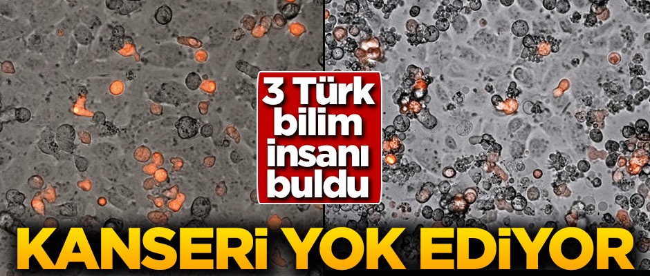 Üç Türk bilim insanı buldu! Kanseri yok ediyor