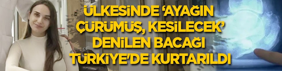 Ülkesinde ‘Ayağın çürümüş, kesilecek