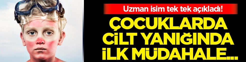 Ultraviyole ışınları uyarısı: Çocuklarda cilt yanığında ilk müdahale! Uzmanı anlattı...