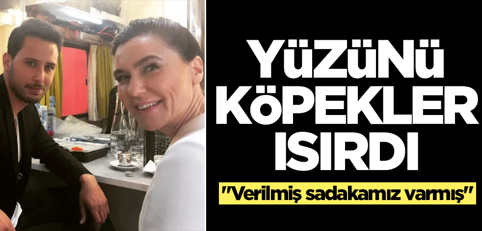 Ünlü oyuncudan kötü haber! Köpekler yüzünü ısırdı... Şok görüntü