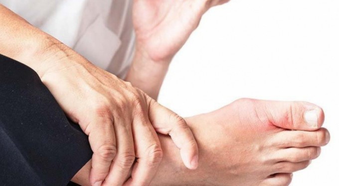 Ürik asit yüksekliği neden olur? Ürik asit yüksekliği hangi bölüme gidilir?