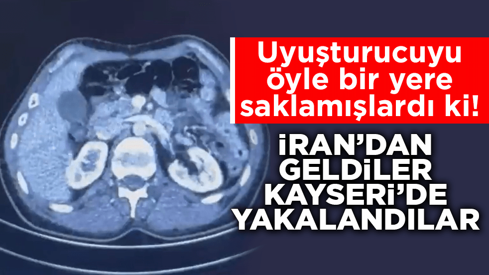 Uyuşturucuyu öyle bir yere saklamışlardı ki! İran’dan geldiler Kayseri’de yakalandılar