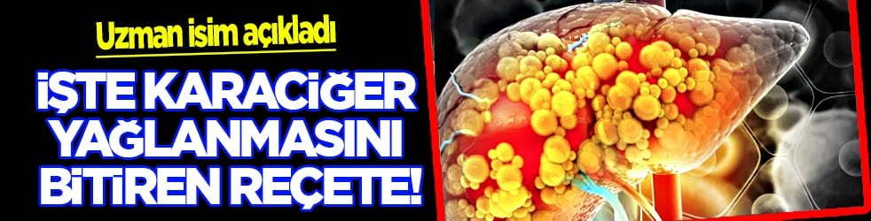 Uzman isim duyurdu: Karaciğer yağlanmasını bitiren reçeteyi açıkladı!