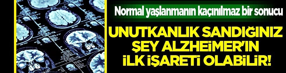 Uzmandan her unutkanlık alzheimer değildir uyarısı: beyin için kritik bir paylaşımla ezberleri bozdu
