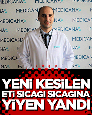  Yeni kesilen eti sıcağı sıcağına yiyen yandı!