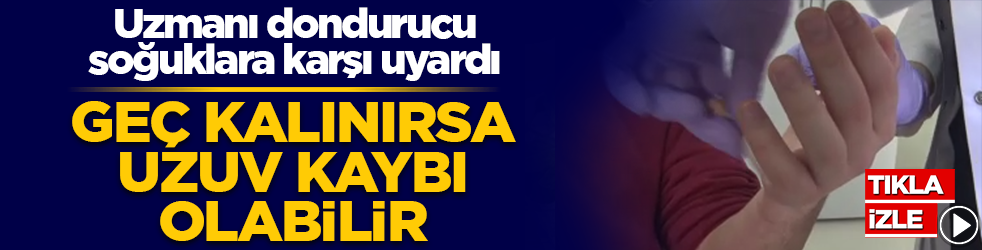 Uzmanlar uyarıyor: Donma belirtilerine dikkat! Soğuk ısırması dokulara zarar verebilir