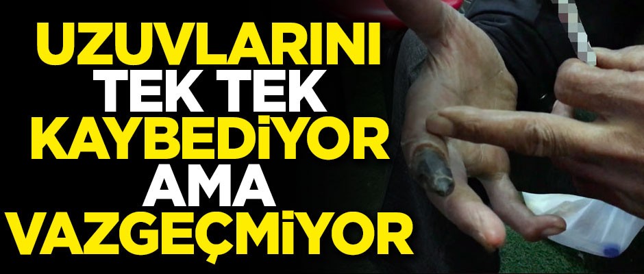 Uzuvlarını tek tek kaybediyor ama hala 'vazgeçemem' diyor