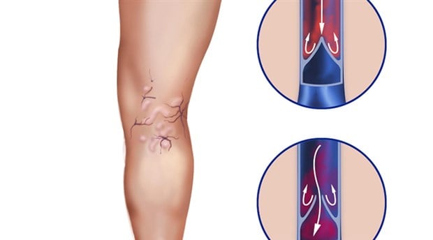 Varis nedir? | Varisler için hangi bitkiler kullanılmalı?