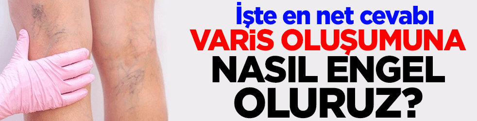 Varis oluşumuna nasıl engel oluruz? İşte en net cevabı