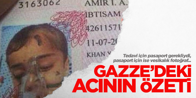 Vesikalık fotoğrafı 'yoğun bakım görüntüsü' olan Gazzeli çocuk...