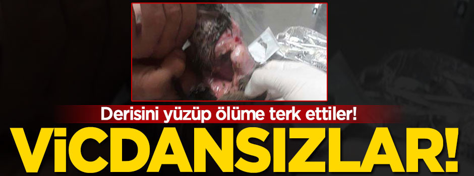 Vicdansızlar! Derisini yüzüp ölüme terk ettiler