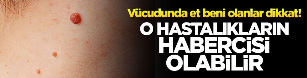 Vücudunda et beni olanlar dikkat! O hastalıkların habercisi olabilir