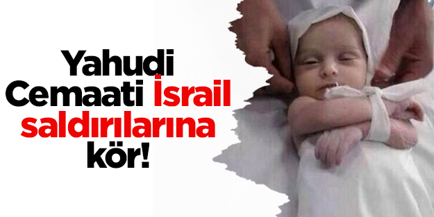 Yahudi Cemaati İsrail saldırılarına kör