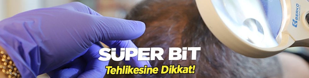 Yanlış duymadınız! Bit uçan veya zıplayan bir canlı değildir! Günde 1 doğru tedbir almalıyız... Bu hatayı yapmayın