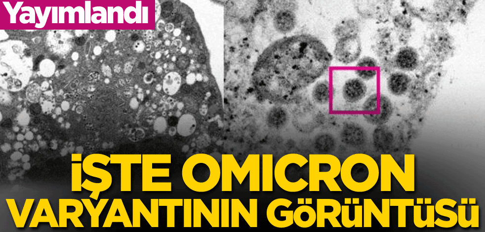 Yayımlandı! İşte Omicron varyantının görüntüsü