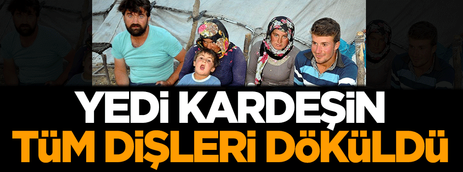 Yedi kardeşin tüm dişleri döküldü