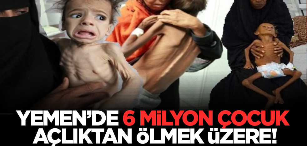 Yemen’de 6 milyon çocuk açlıktan ölmek üzere!