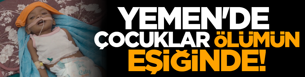 Yemen'de çocuklar ölümün eşiğinde!