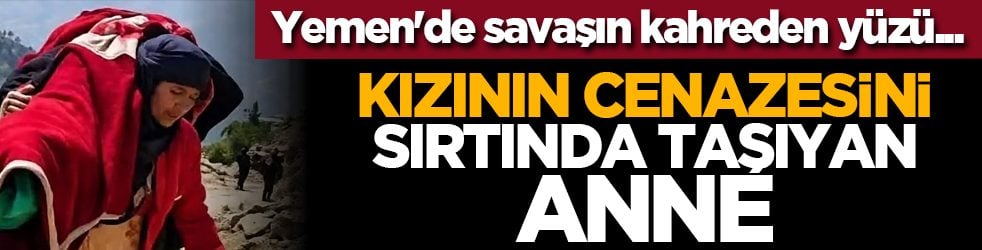 Yemen'de savaşın kahreden yüzü... Kızının cenazesini sırtında taşıyan anne