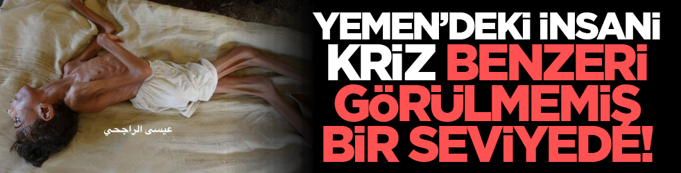 Yemen’deki insani kriz benzeri görülmemiş bir seviyede!
