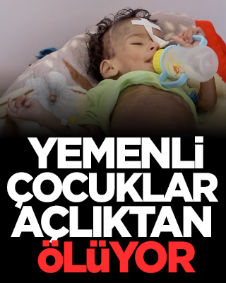 Yemenli çocuklar açlıktan ölüyor