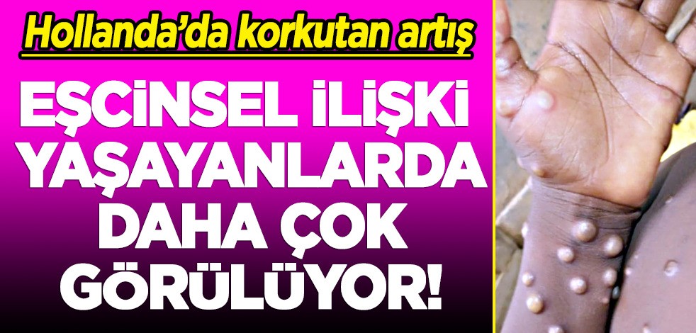 Yeni bir virüs mü var? Hollanda'da korkutan artış! İlk kez bini geçti