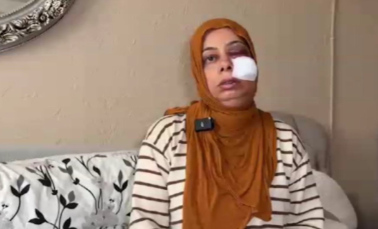 Bir anlık dikkatsizlik canına mal oluyordu! Talihsiz kazada yüzüne 14 dikiş atıldı