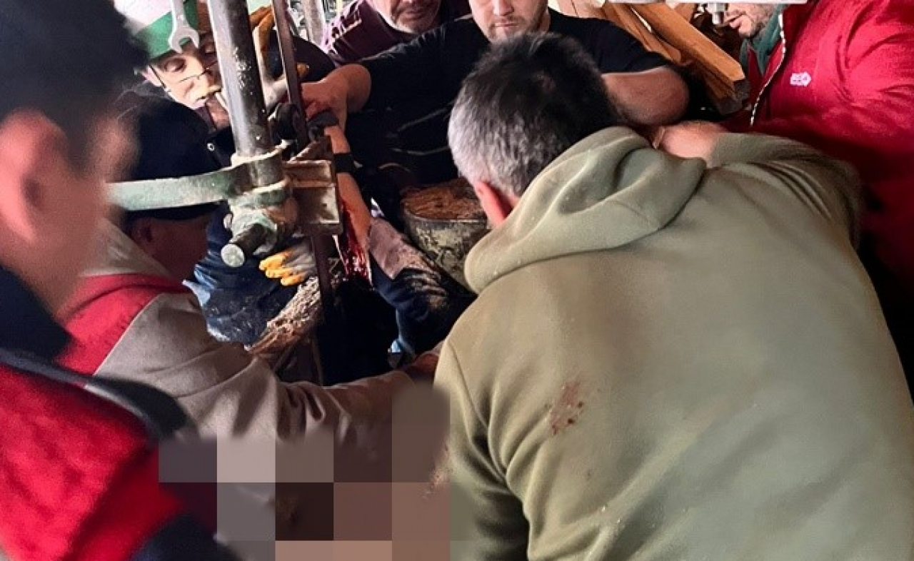 Boyabat’ta korkunç iş kazası: İşçi kolunu hızar makinesine kaptırdı