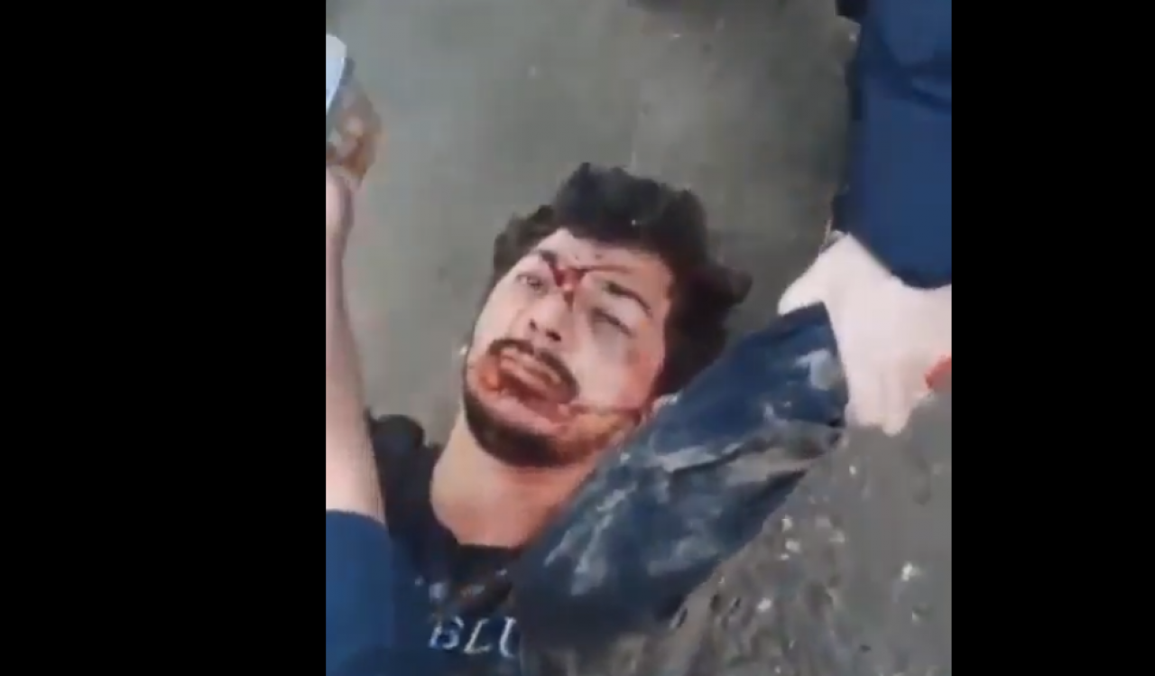 Dün bayrağımızı yakmıştı! Bu sabah etkisiz hale getirildi! Alçak eylem cezasız kalmadı