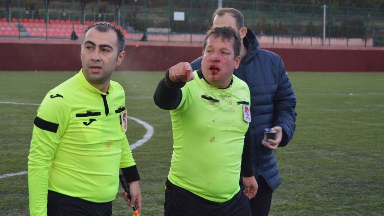 Görmek istemediğimiz görüntüler! Amatör küme maçında kan döküldü