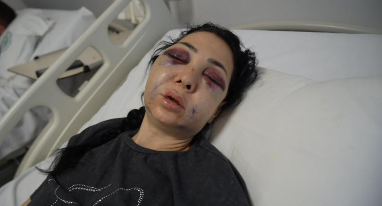 Ölümün kıyısından dönen anneye ‘davadan vazgeç’ tehdidi: Magandaların küstahlığı sınır tanımıyor