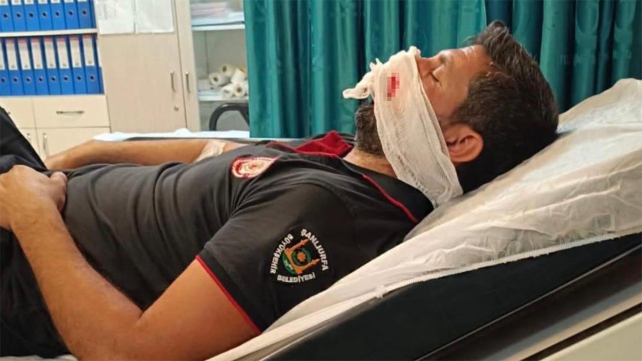 Patlayan lastik itfaiyeciyi hastanelik etti