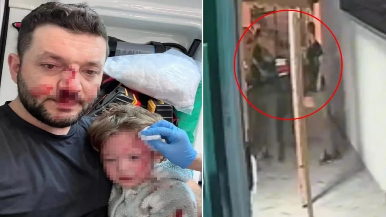 Tüm Türkiye’yi ayağa kaldıran olayda sıcak gelişme! Baba ile 14 aylık bebeğinin tekme tokat dövüldüğü görüntüler ortaya çıktı