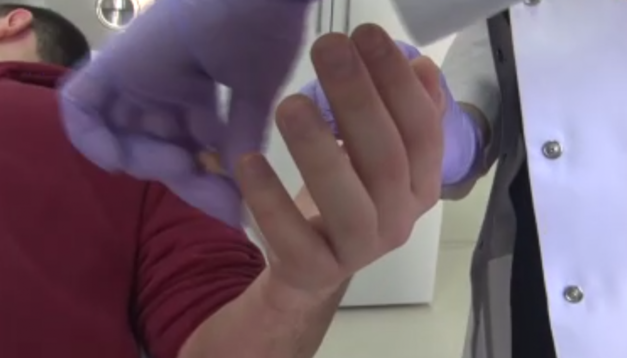 Uzmanlar uyarıyor: Donma belirtilerine dikkat! Soğuk ısırması dokulara zarar verebilir