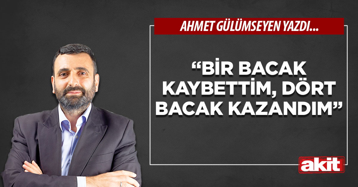 “Bir bacak kaybettim, dört bacak kazandım”