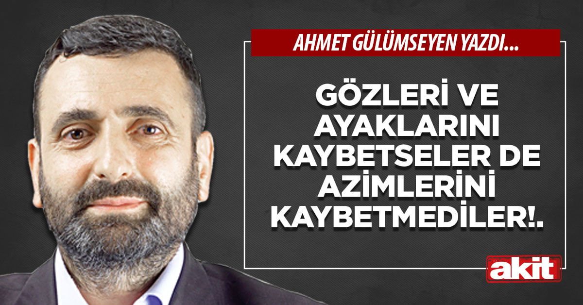 Gözleri ve ayaklarını kaybetseler de azimlerini kaybetmediler!.